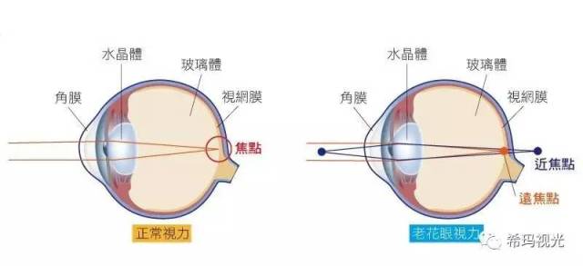 哪些地方老花眼人口多