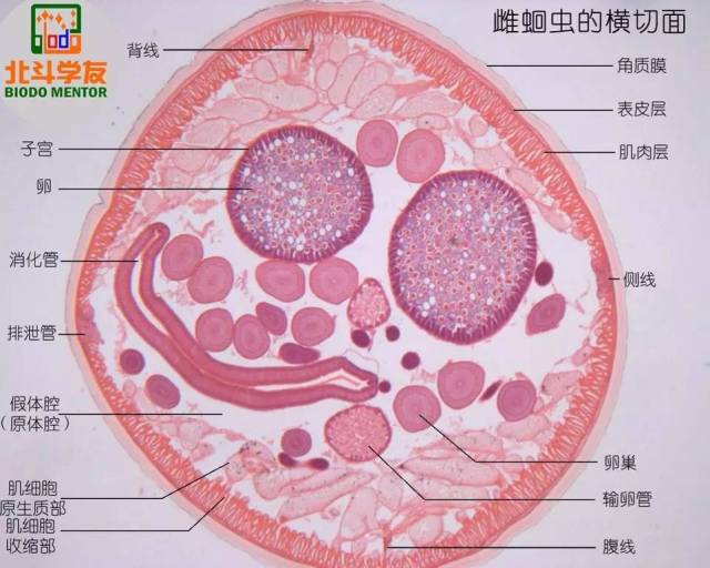 【干货】生物竞赛《动物实验》之蛔虫和环毛蚓的解剖