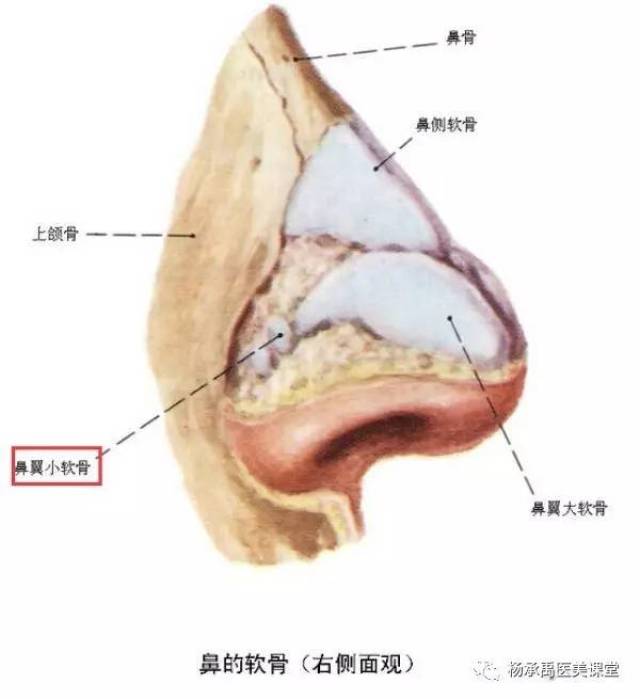 鼻综合整形