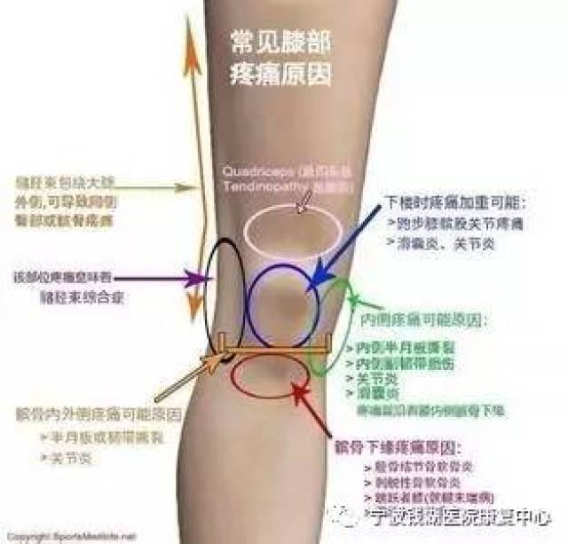 当患者出现膝内侧痛: 1,髂胫束损伤. 2,内侧副韧带损伤.