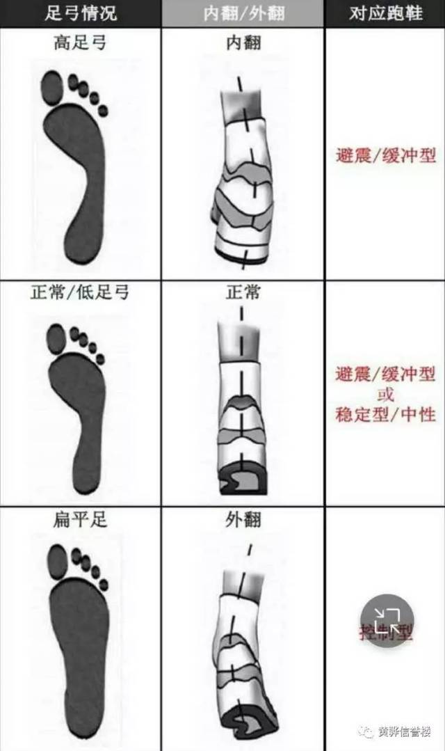 高弓足和扁平足的测量方法:把脚弄湿,印在薄纸上.