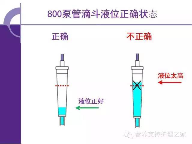 肠内营养泵使用和故障排除