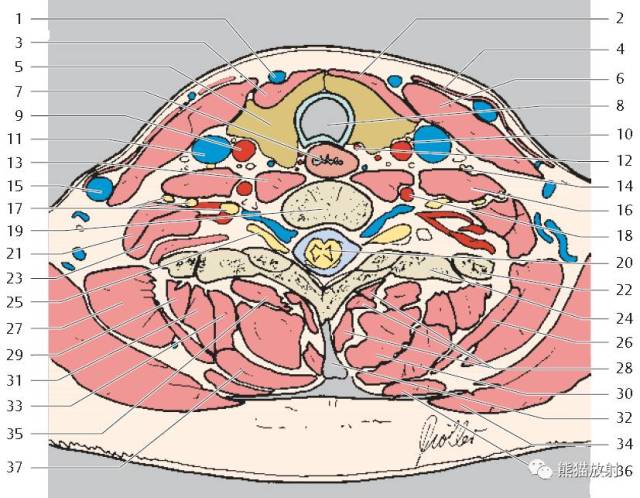 (3) 咽后间隙:位于咽,食管后壁与椎前筋膜之间,下续后纵膈,其外侧为