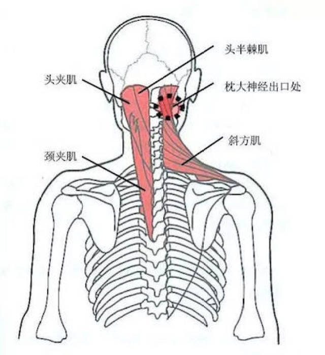 放松颈肩,怎么能不知颈肩压痛点呢?