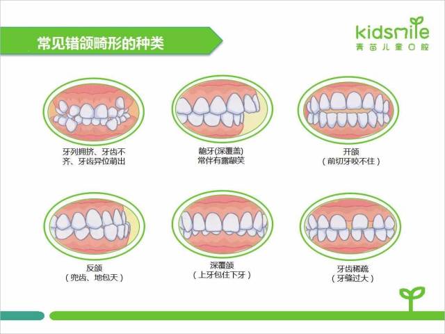 换牙之后,孩子牙齿拥挤不齐怎么办?