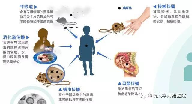 肾衰竭人口_慢性肾衰竭图片(2)