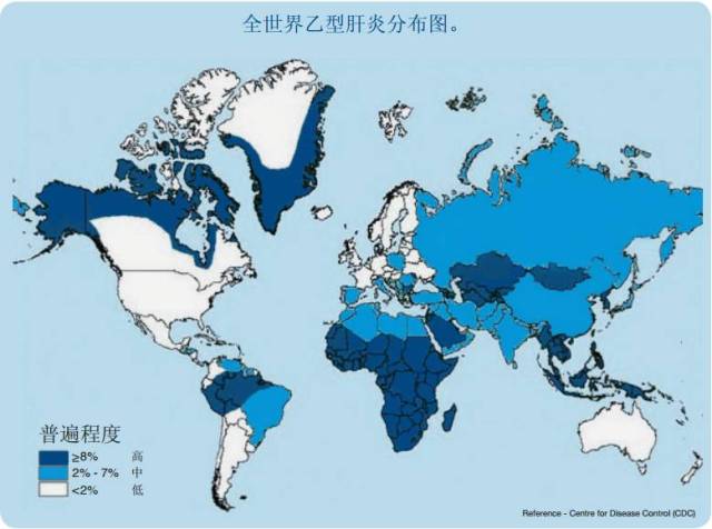 最新研究:澳洲乙肝患者80%是华人,患肝癌几率