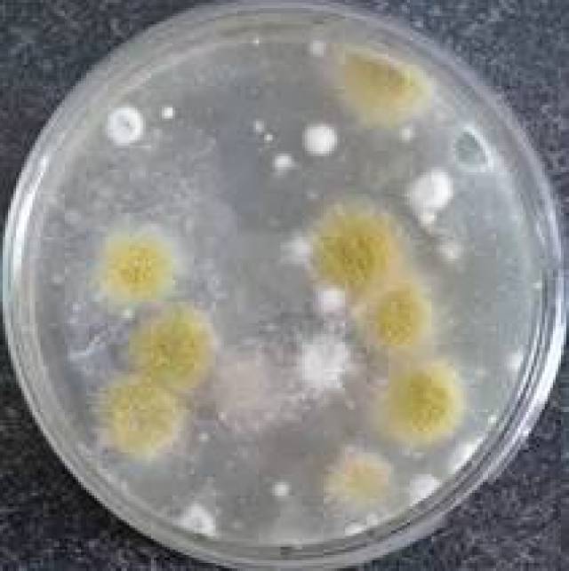 片上, 显微镜下观察可见霉菌孢子.如图6