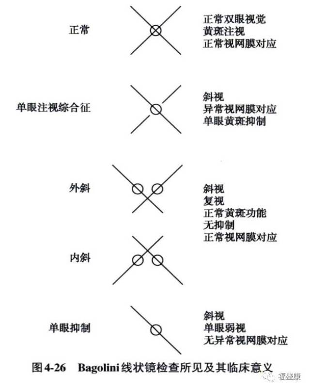 【专业】双眼单视功能检查(bagolini线状镜《斜视弱视检查法》