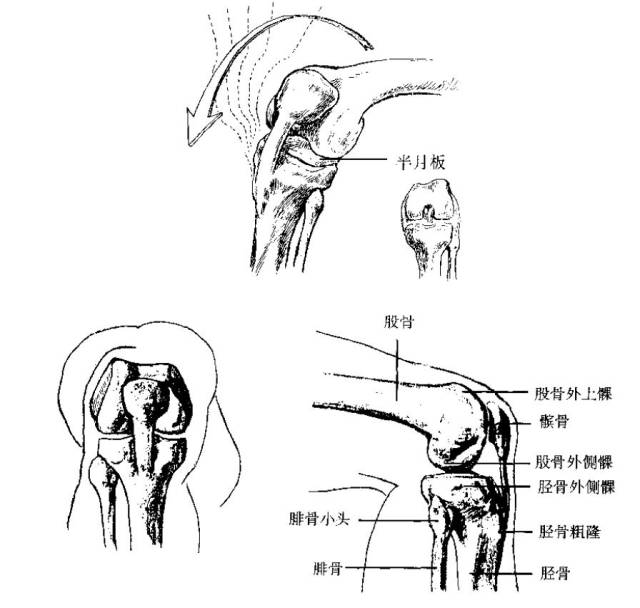 脚关节内髁是胫骨下头,外髁是腓骨下头,胫骨下端内踝高于腓骨下端外踝