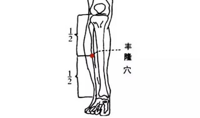 拔罐| 痰湿体质的拔罐调理法