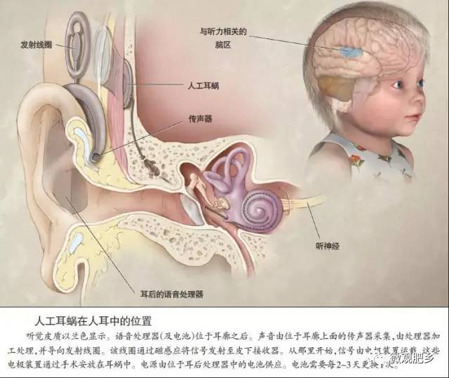 儿童服务网——项目申请—— "七彩梦行动计划"聋儿(人工耳蜗)康复