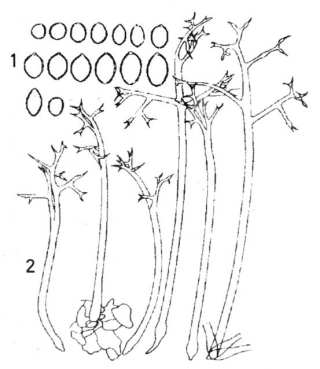 图:黄瓜霜霉病病菌(1,孢子囊;2,嬗子梗)