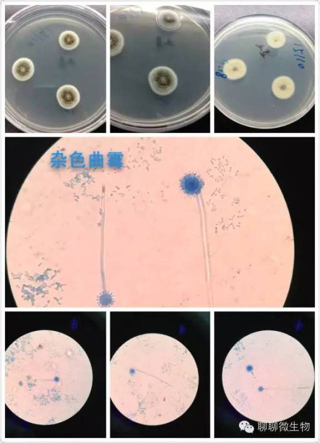 【干货】曲霉辨识心得