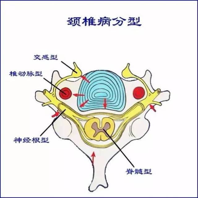 骨病,骨痛的相关知识,一定要好好收藏.