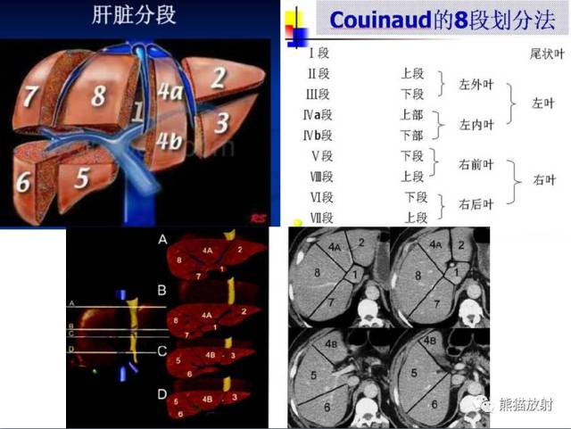 【解剖】上腹部ct断层[双语(肝脏解剖及肝段分布,腹部淋巴结分布)