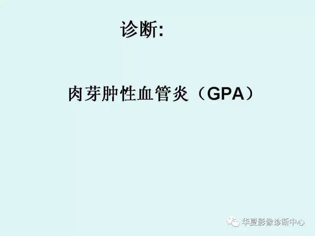 肉芽肿性血管炎(gpa)