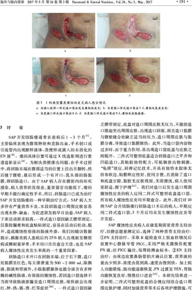 重症急性胰腺炎合并结肠瘘术后回肠造口周围炎患者的护理