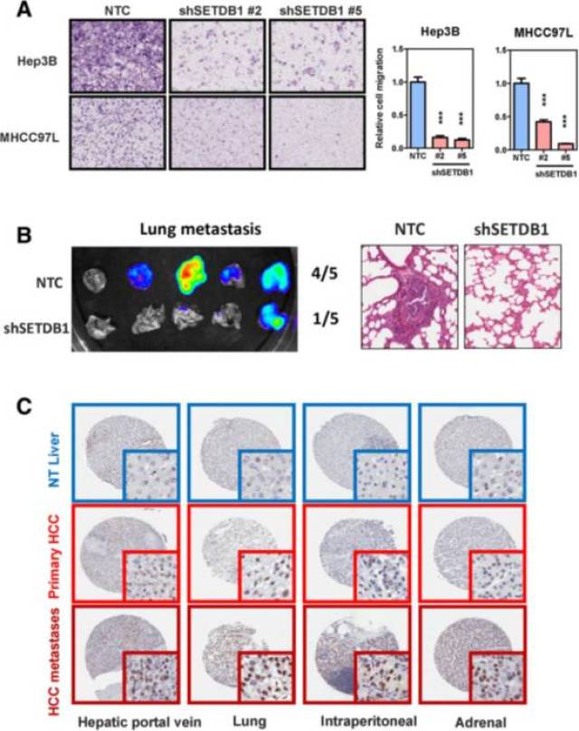 4 setdb1表达上调促进hcc肝外转移 (a)体外transwell实验,敲低setdb1