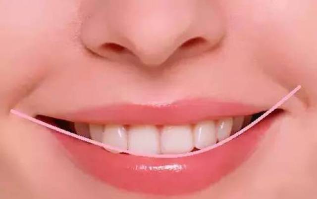 同时,牙齿的排列要符合美学标准的弧度,达到国际公认最美的牙齿笑线