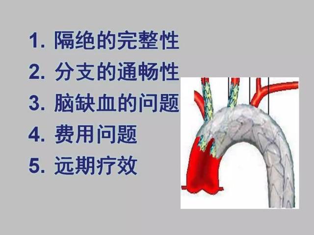 冯睿:主动脉弓烟囱技术经验探讨