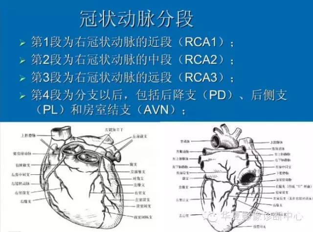冠状动脉解剖,分段及基本疾病诊断