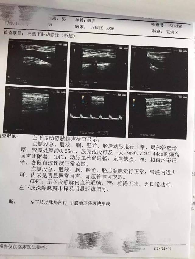 今晚预告 | 病例讨论:脑梗塞后遗症合并严重创伤患者一例