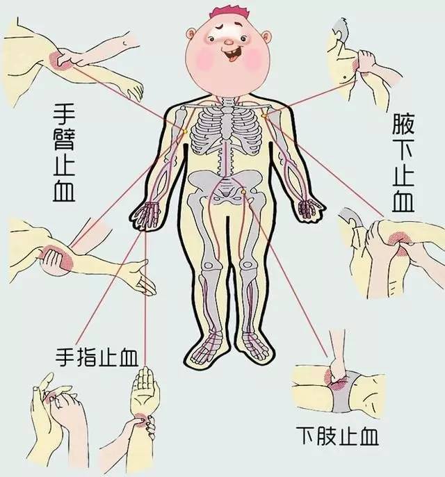 2,伤口出血量很大或伤口很深,抬高受伤部位,用纱布或干净的毛巾按压