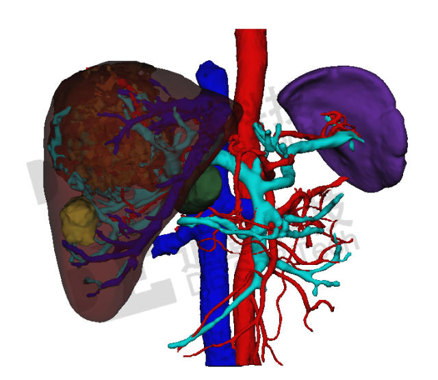 道壹科技肝脏三维重建效果