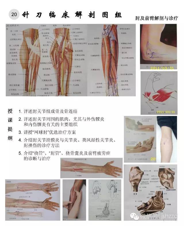 针刀临床解剖图谱,针刀人必收藏