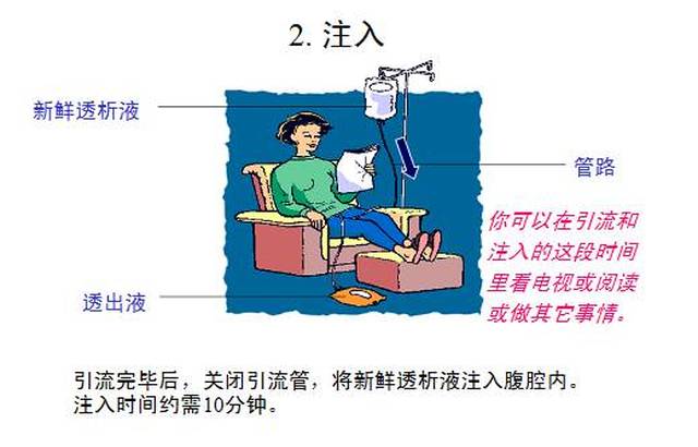 【知识】你需要了解的腹膜透析小知识