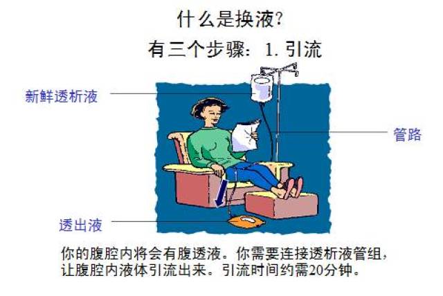 【知识】你需要了解的腹膜透析小知识