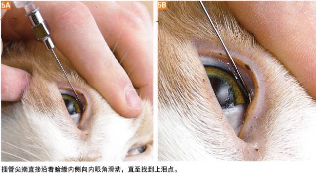 解决顽固性泪痕的绝佳方法——鼻泪管冲洗术