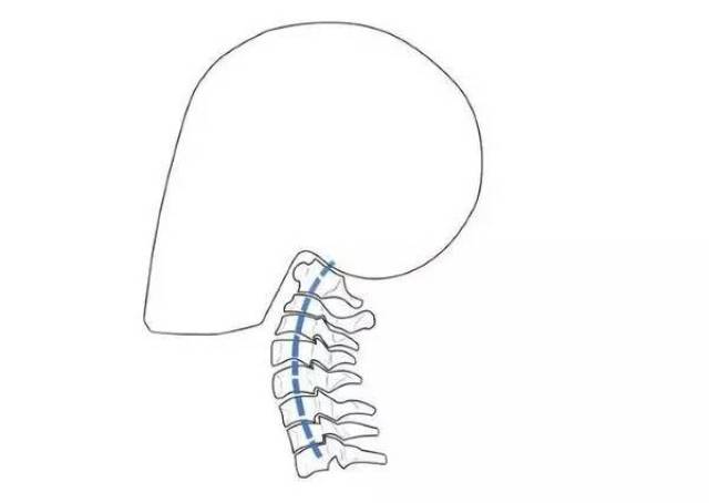 颈椎有一个正常的生理曲线(颈曲),强行掰它,很容易导致脖子疼痛,甚至
