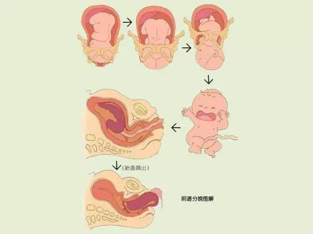 产妇分娩时,胎儿是这样从产道出生的!