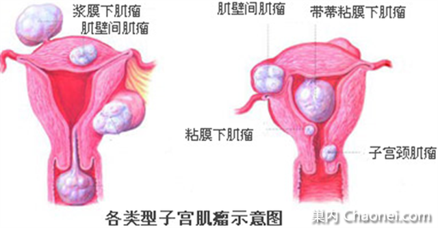 人口增长 指望 子宫(2)