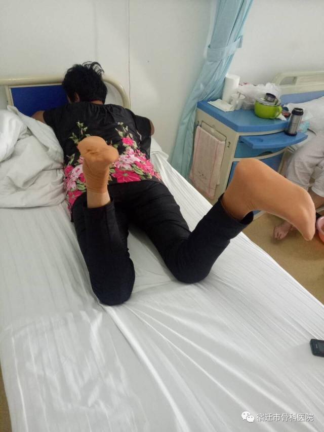 患者王某,女性,61岁,因"右膝关节置换手术后一年关节僵直12个月"入院