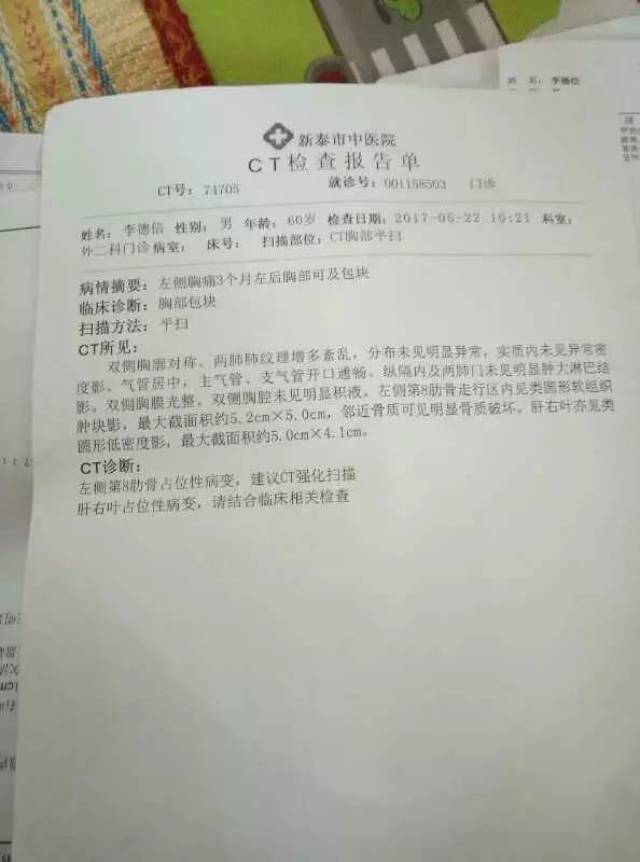 最新|肝癌患者李德信病例