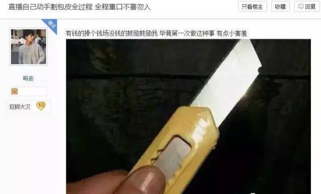 广西一男子自己在家割包皮,于是悲剧了.