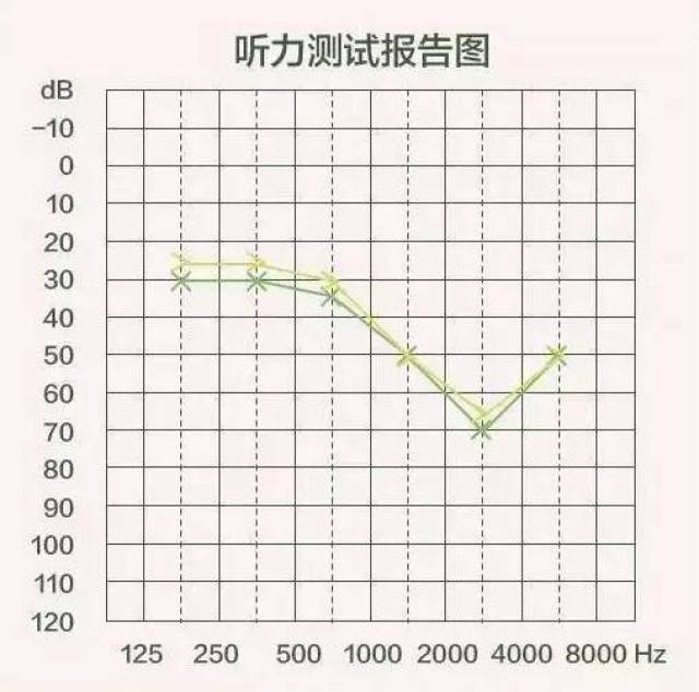 你真的读懂听力图了吗?