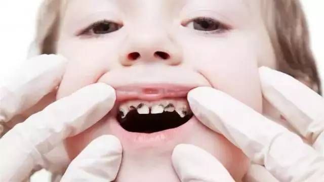 【美年健康】8岁男孩牙齿全掉光,竟是发育过早惹的祸!