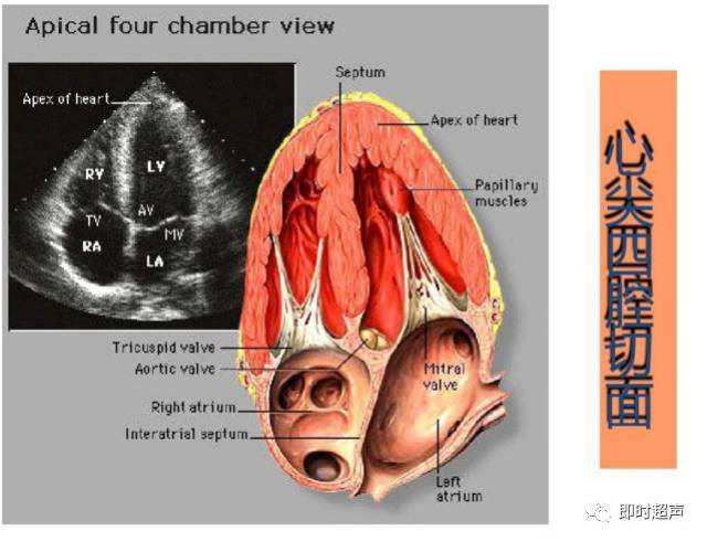 正常心脏超声解剖
