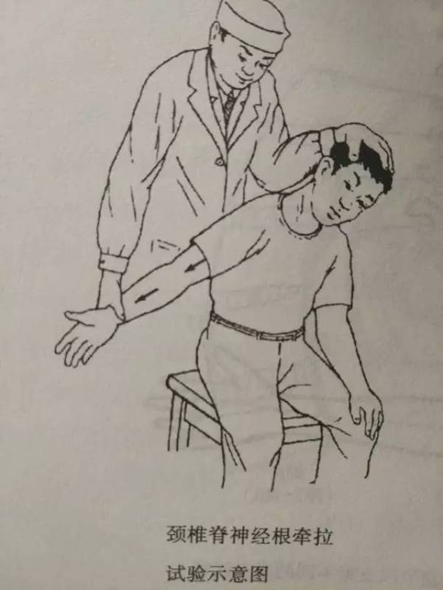 臂丛神经牵拉试验:病人低头,检查者一手扶病人头部,另一手拉病人腕部