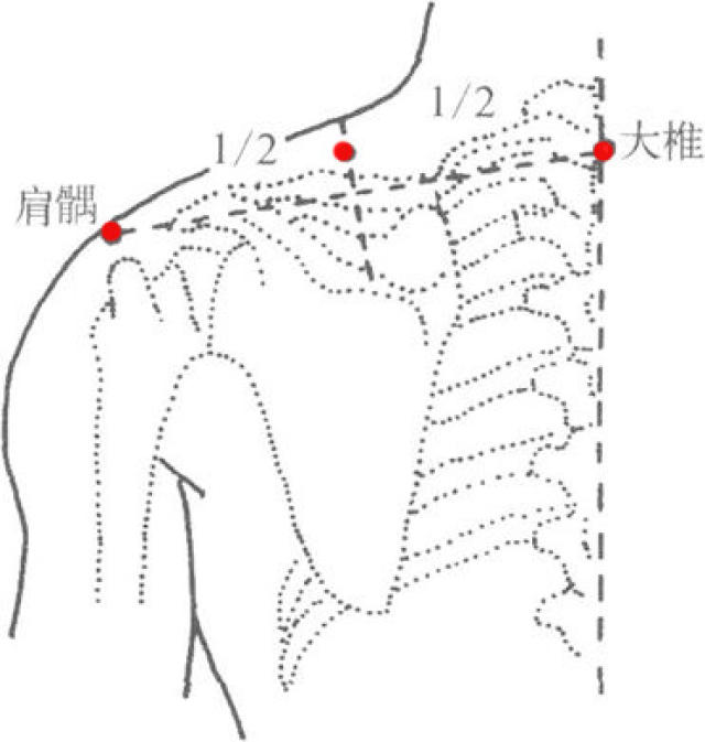 三分钟快速诊断肩周疾病,艾灸可调理肩周问题