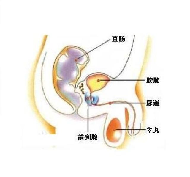 这些因素决定了前列腺容易患炎症:如何预防?