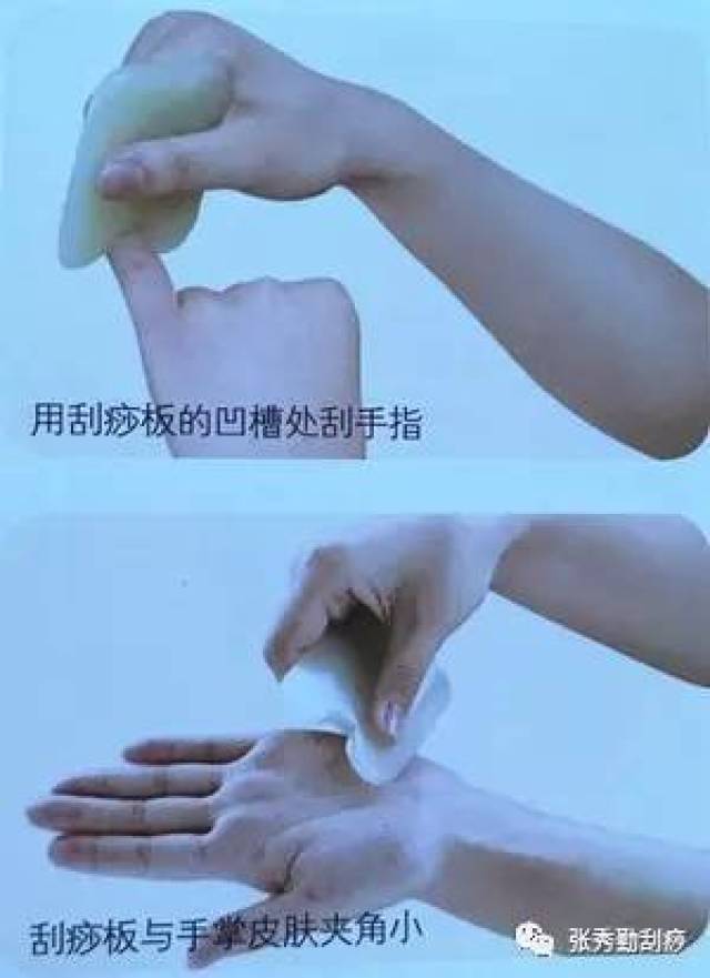 用刮痧板凹槽分别缓慢刮拭各手指,从指根部一直刮到手指尖.