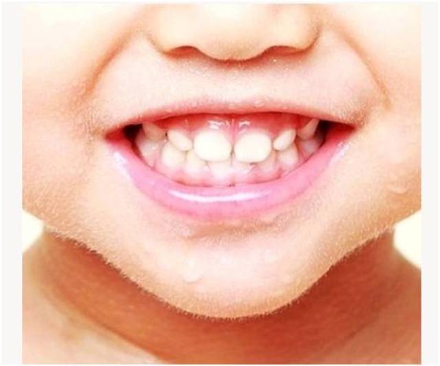 爱护牙齿从小做起,让宝妈们有方法地呵护宝宝,见证他们的一路健康成长