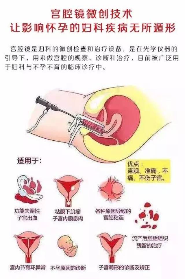 【特色技术】让影响怀孕的妇科病无所遁形的——宫腔镜微创技术