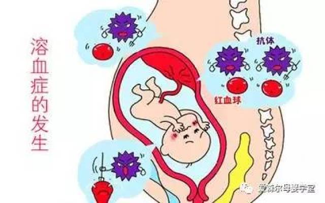 此病发生率和血液遗传的关系 目前发生的新生宝宝溶血病主要见于abo