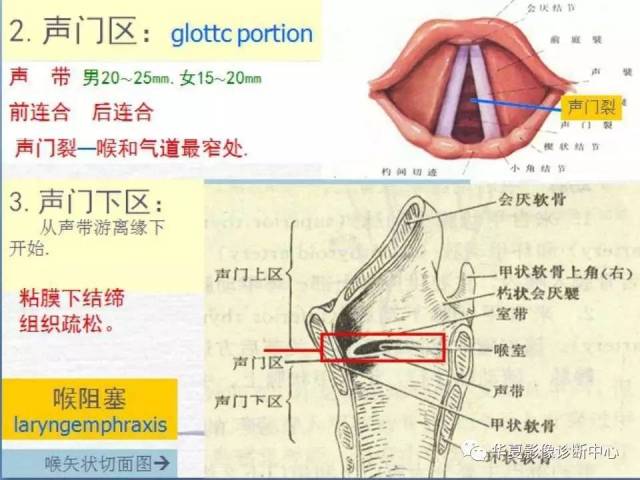 【影像基础】喉部解剖及各型喉癌的ct表现简记